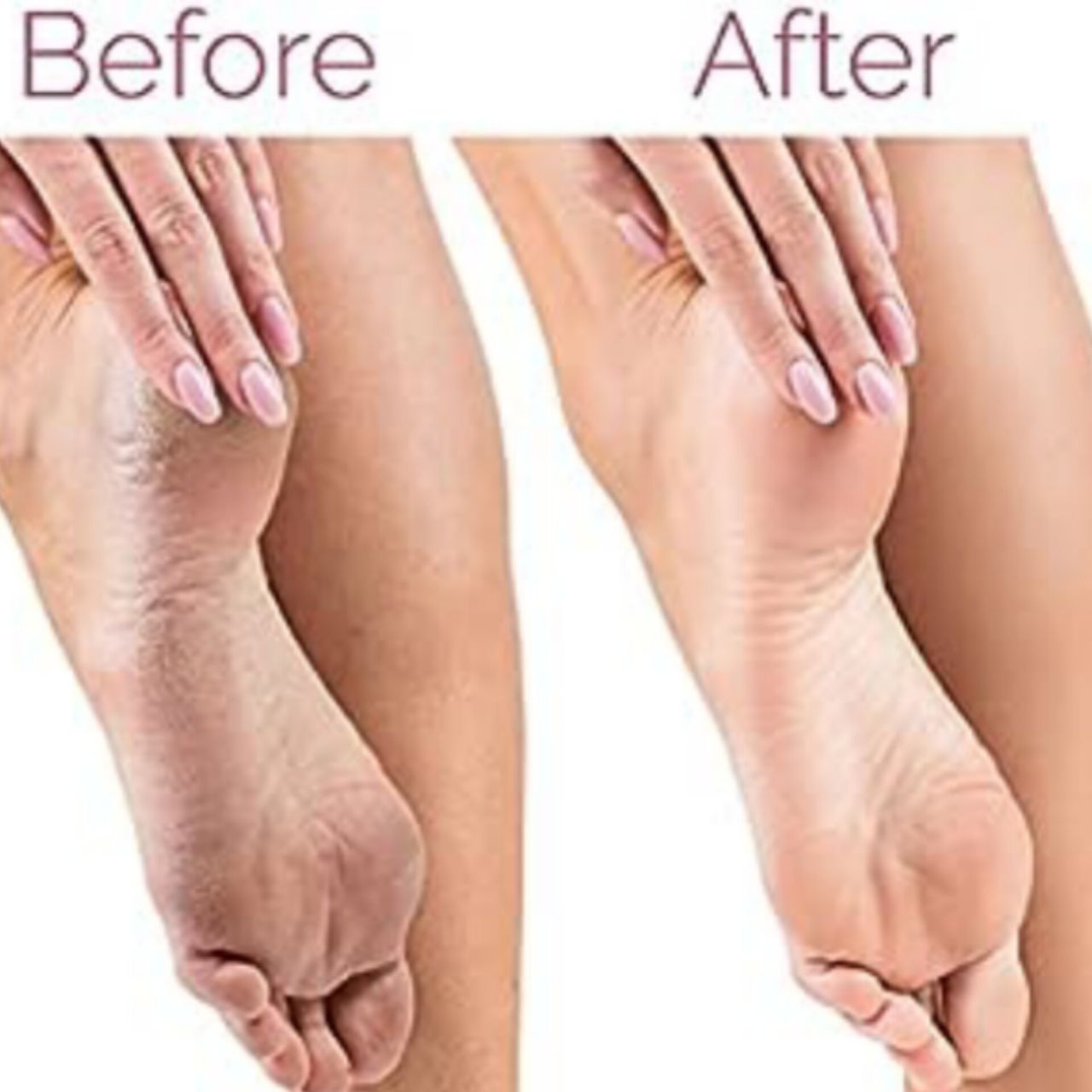 أداة باديكير للعناية بالقدمين Finishing Touch Flawless Pedi