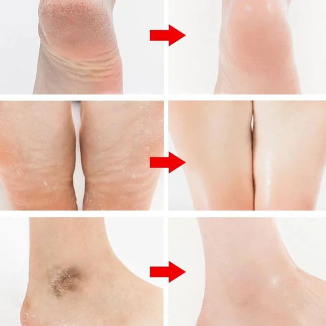 أداة باديكير للعناية بالقدمين Finishing Touch Flawless Pedi